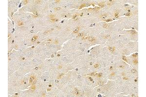 STAT5 Mouse Monoclonal Antibody at 1/100 staining rat brain tissue by IHC-P.