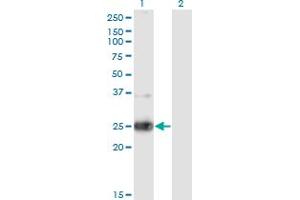 Western Blot analysis of NXPH3 expression in transfected 293T cell line by NXPH3 monoclonal antibody (M05), clone 4C8. (NXPH3 抗体  (AA 1-252))