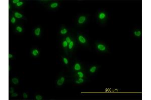 Immunofluorescence of monoclonal antibody to TAF11 on HeLa cell. (TAF11 抗体  (AA 158-210))