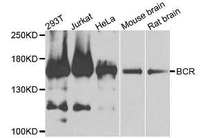 Western blot analysis of extracts of various cell lines, using BCR antibody. (BCR 抗体  (AA 1-300))