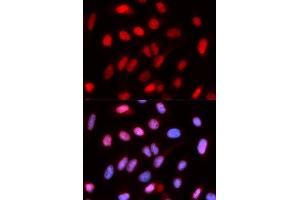 Immunofluorescence analysis of U2OS cells using RFC4 antibody. (RFC4 抗体  (AA 204-363))