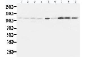 Lane 9: HELA Cell Lysate (EPHA1 抗体  (C-Term))