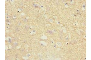 Immunohistochemistry of paraffin-embedded human brain tissue using ABIN7173721 at dilution of 1:100 (Tppp 抗体  (AA 1-219))