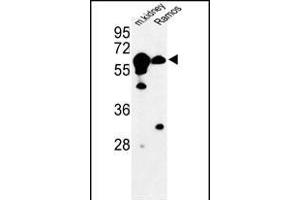 Western blot analysis of CBS Antibody (N-term) (ABIN1881141 and ABIN2841140) in mouse kidney tissue and Ramos cell line lysates (35 μg/lane). (CBS 抗体  (N-Term))