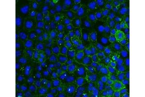 IF analysis of ITGB4 using anti-ITGB4 antibody (ABIN7601134). (Integrin beta 4 抗体  (AA 29-431))
