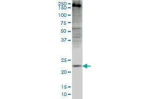 CRYGD monoclonal antibody (M03), clone 4E12 Western Blot analysis of CRYGD expression in HepG2 . (CRYGD 抗体  (AA 75-174))
