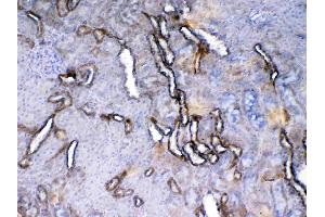 IHC analysis of VEGF Receptor 2 using anti-VEGF Receptor 2 antibody . (VEGFR2/CD309 抗体  (AA 20-244))