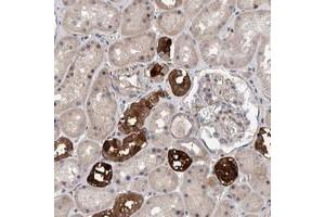 Immunohistochemical staining of human kidney with SLC45A4 polyclonal antibody  shows strong cytoplasmic positivity in subsets of renal tubules. (SLC45A4 抗体)