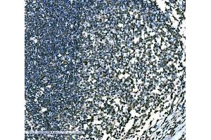 IHC analysis of SnoN/SNO/SKIL using anti-SnoN/SNO/SKIL antibody (ABIN7599455).