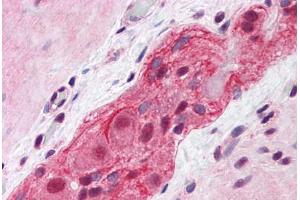 Human Small Intestine, Myenteric Plexus: Formalin-Fixed, Paraffin-Embedded (FFPE) (MED17 抗体  (AA 551-652))
