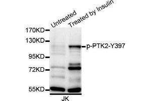 Western blot analysis of extracts of Jurkat cell line, using Phospho-PTK2-Y397 antibody. (FAK 抗体  (pTyr397))