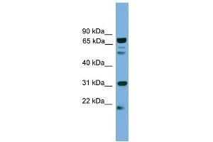 WB Suggested Anti-SLC6A3 Antibody Titration:  0. (SLC6A3 抗体  (N-Term))