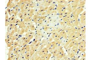 IHC image of ABIN7152350 diluted at 1:500 and staining in paraffin-embedded human heart tissue performed on a Leica BondTM system. (SOD3 抗体  (AA 19-160))