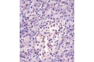 Immunohistochemistry (Paraffin-embedded Sections) (IHC (p)) image for anti-Meningioma Expressed Antigen 5 (Hyaluronidase) (MGEA5) (AA 236-269) antibody (ABIN6244040)
