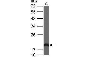WB Image Sample (50 ug of whole cell lysate) A: Mouse brain 12% SDS PAGE antibody diluted at 1:1000 (HPCAL1 抗体)