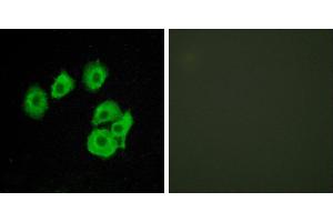 Peptide - +Western blot analysis of extracts from COS7 cells, using CLTR1 antibody. (CysLTR1 抗体  (Internal Region))