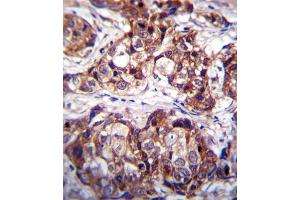 Immunohistochemistry (IHC) image for anti-Discoidin Domain Receptor tyrosine Kinase 1 (DDR1) antibody (ABIN3003119) (DDR1 抗体)