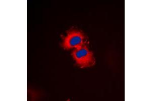 Immunofluorescent analysis of ZAK staining in HeLa cells. (ZAK 抗体  (C-Term))