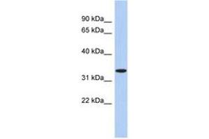 Image no. 1 for anti-Aspartoacylase (ASPA) (AA 71-120) antibody (ABIN6743962) (ASPA 抗体  (AA 71-120))