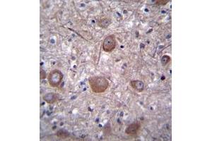 Immunohistochemistry analysis in formalin fixed and paraffin embedded human brain tissue reacted with PPP3CC / CALNA3 Antibody (N-term) followed by peroxidase conjugation of the secondary antibody and DAB staining.
