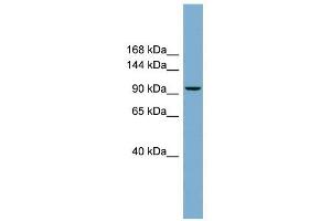 PPP1R3A antibody used at 1 ug/ml to detect target protein. (PPP1R3A 抗体)