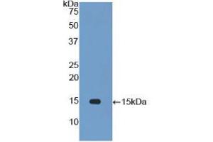 Western blot analysis of recombinant Rat IL34. (IL-34 抗体  (AA 21-234))