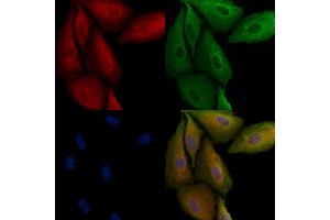 ABIN6264833 and ABIN6279044 staining  cells by IF/ICC. (RPL29 抗体  (Internal Region))