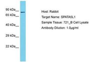 Image no. 1 for anti-Spermatogenesis Associated 5-Like 1 (SPATA5L1) (AA 580-629) antibody (ABIN6750664) (SPATA5L1 抗体  (AA 580-629))