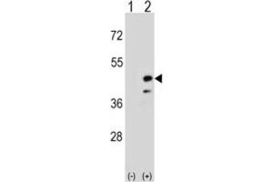Western Blotting (WB) image for anti-Creatine Kinase, Mitochondrial 2 (Sarcomeric) (CKMT2) antibody (ABIN3002971) (CKMT2 抗体)