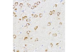 Immunohistochemistry of paraffin-embedded mouse brain using MCL1 Rabbit pAb (ABIN3020787, ABIN3020788, ABIN3020789 and ABIN6213724) at dilution of 1:100 (40x lens). (MCL-1 抗体  (AA 120-220))