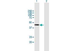 Western Blot analysis of TSPY2 expression in transfected 293T cell line by TSPY2 MaxPab polyclonal antibody. (TSPY2 抗体  (AA 1-308))