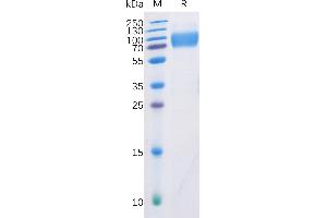 SDS-PAGE (SDS) image for CD226 (CD226) (AA 19-247) protein (mFc-His Tag) (ABIN6961117)