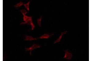 ABIN6274316 staining LOVO by IF/ICC. (TLE2 抗体  (Internal Region))