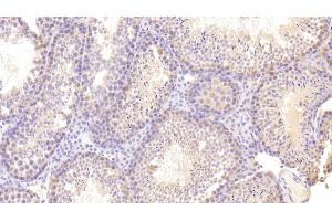 Immunohistochemistry (IHC) image for anti-Mast/stem Cell Growth Factor Receptor (KIT) (AA 343-527) antibody (ABIN7431110)