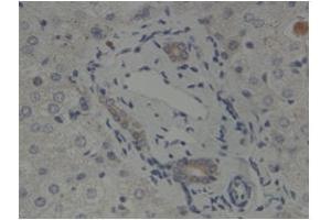 Sample Type:  Human Bile DuctPrimary   Dilution:  1:500 (GLIS2 抗体  (N-Term))