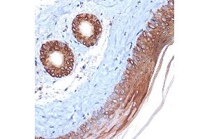 Immunohistochemistry (IHC) image for anti-Keratin 2 (KRT2) antibody (ABIN1680763)