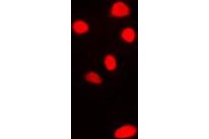 Immunofluorescent analysis of RPL11 staining in H9C2 cells. (RPL11 抗体  (C-Term))