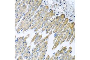 Immunohistochemistry of paraffin-embedded mouse stomach using NDUFB10 antibody (ABIN5972156) at dilution of 1/100 (40x lens). (NDUFB10 抗体)