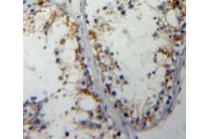 Used in DAB staining on fromalin fixed paraffin-embedded testis tissue (Cdc25 抗体  (AA 376-524))
