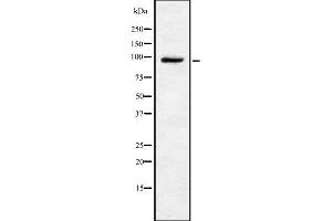 Western blot analysis of TRPV4 using HeLa whole cell lysates (TRPV4 抗体  (C-Term))
