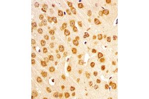 (ABIN6243917 and ABIN6577996) staining (Mouse) Nr4a2 in mouse brain sections by Immunohistochemistry (IHC-P - paraformaldehyde-fixed, paraffin-embedded sections).