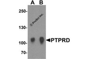 Western Blotting (WB) image for anti-Protein tyrosine Phosphatase, Receptor Type, D (PTPRD) (N-Term) antibody (ABIN1031529) (PTPRD 抗体  (N-Term))
