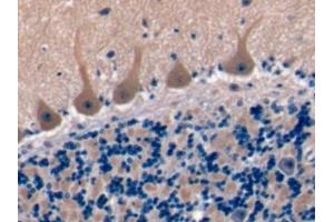Detection of TSPAN1 in Human Cerebellum Tissue using Polyclonal Antibody to Tetraspanin 1 (TSPAN1) (TSPAN1 抗体  (AA 112-215))