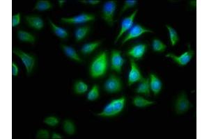 Immunofluorescence staining of A549 cells with ABIN7144534 at 1:166, counter-stained with DAPI. (ALOX15B 抗体  (AA 1-676))