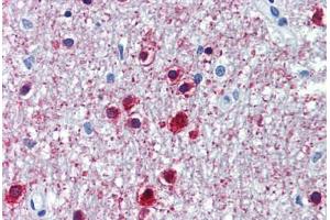 Human Brain, Cerebellum (formalin-fixed, paraffin-embedded) stained with ONECUT1 antibody ABIN462211 followed by biotinylated goat anti-rabbit IgG secondary antibody ABIN481713, alkaline phosphatase-streptavidin and chromogen. (ONECUT1 抗体  (C-Term))