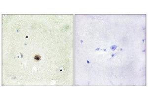 Immunohistochemistry (IHC) image for anti-Cysteine and Glycine-Rich Protein 1 (CSRP1) (Internal Region) antibody (ABIN1849240) (CSRP1 抗体  (Internal Region))