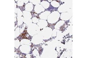 Immunohistochemical staining of human bone marrow with MEIG1 polyclonal antibody  shows strong cytoplasmic and nuclear positivity in subsets of hematopoietic cells at 1:200-1:500 dilution. (MEIG1 抗体)