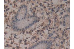 Immunohistochemistry (IHC) image for anti-Annexin A6 (ANXA6) (AA 2-251) antibody (ABIN7434836)