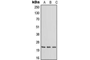 Western blot analysis of RAB30 expression in HeLa (A), mouse liver (B), rat liver (C) whole cell lysates. (RAB30 抗体  (Center))