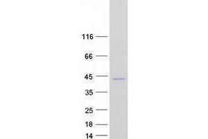 Western Blotting (WB) image for Torsin Family 1, Member B (Torsin B) (TOR1B) protein (Myc-DYKDDDDK Tag) (ABIN2734030)